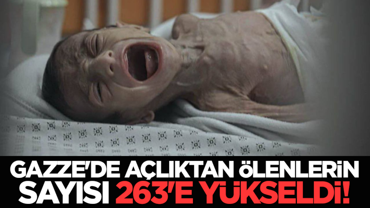 Gazze'de açlıktan ölenlerin sayısı 263'e yükseldi!