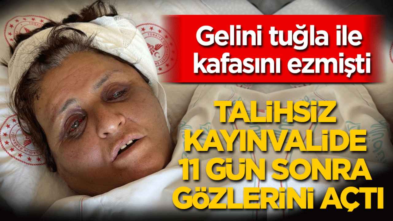 Gelini tuğla ile kafasını ezmişti! Talihsiz kayınvalide 11 gün sonra gözlerini açtı