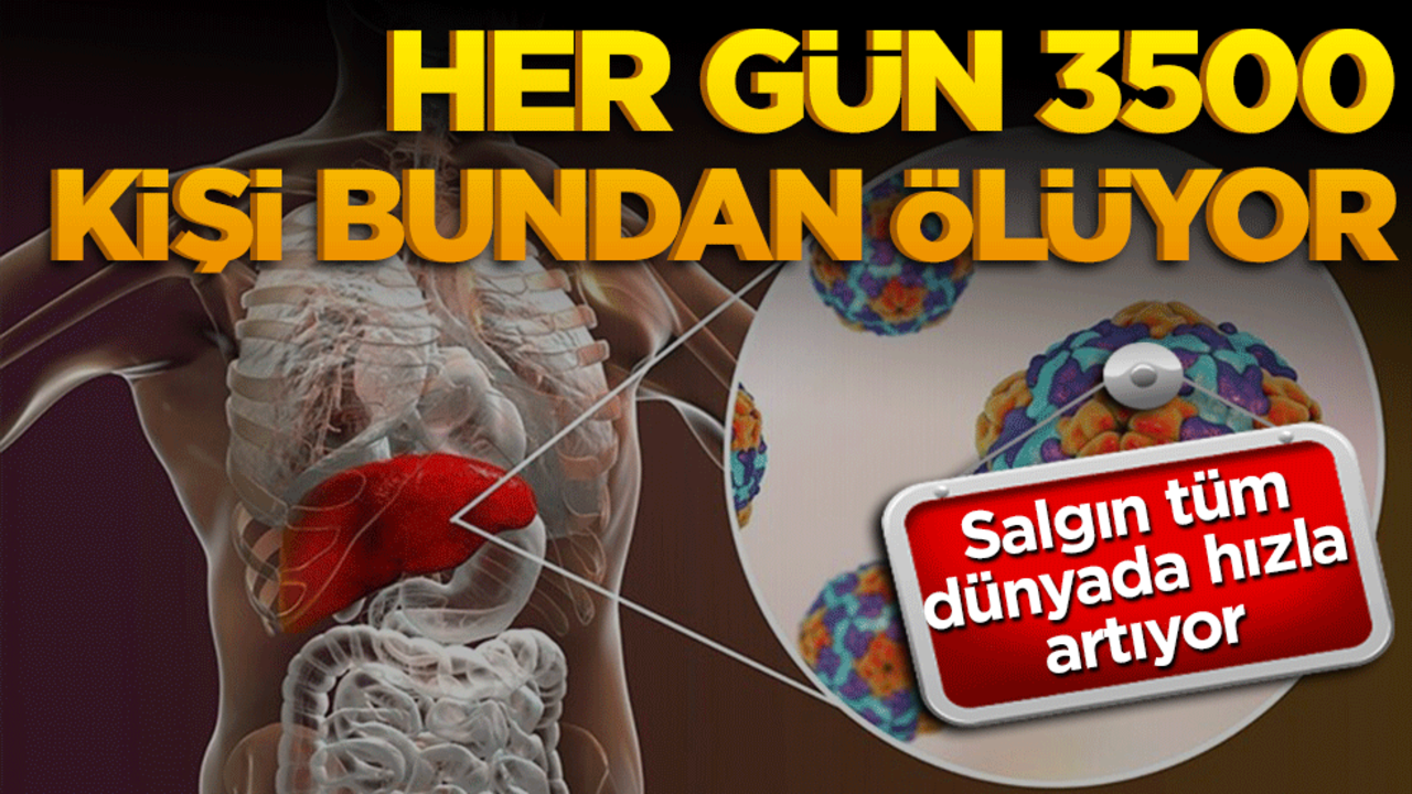 Hepatit salgını hızla artıyor! Her gün 3 bin 500 ölüm
