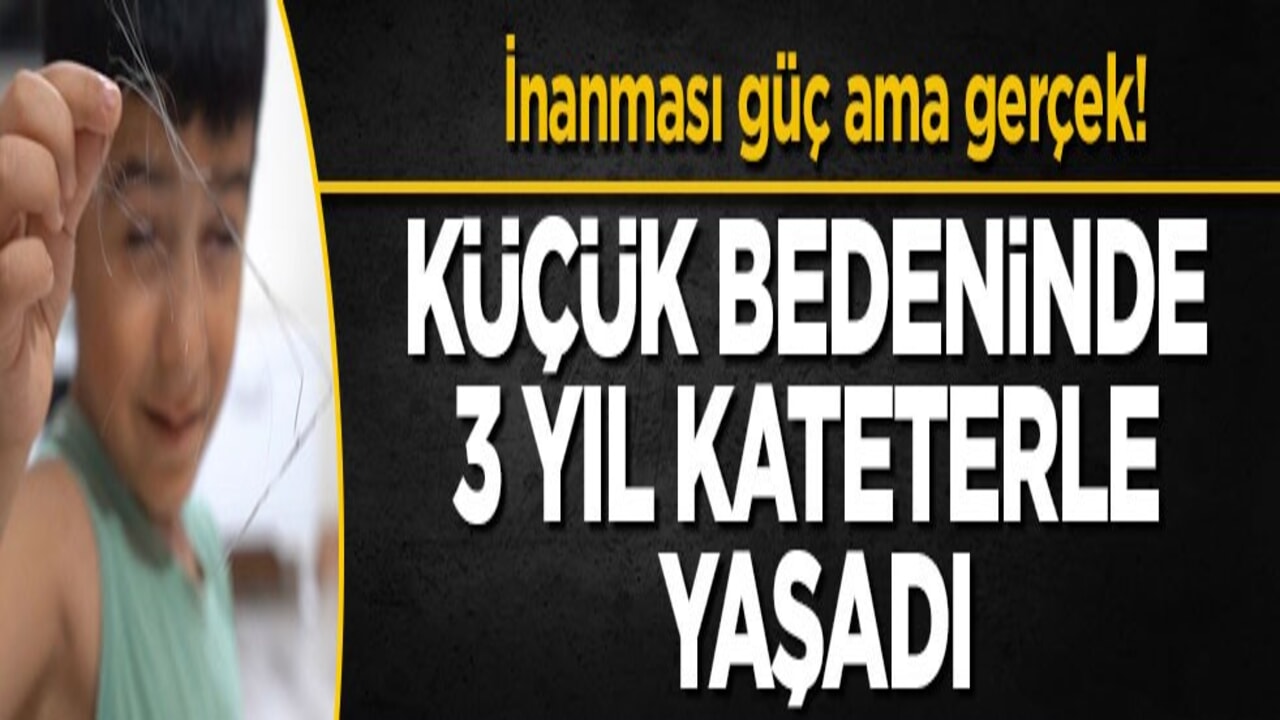 İnanması güç ama gerçek! Küçük bedeninde 3 yıl kateterle yaşadı