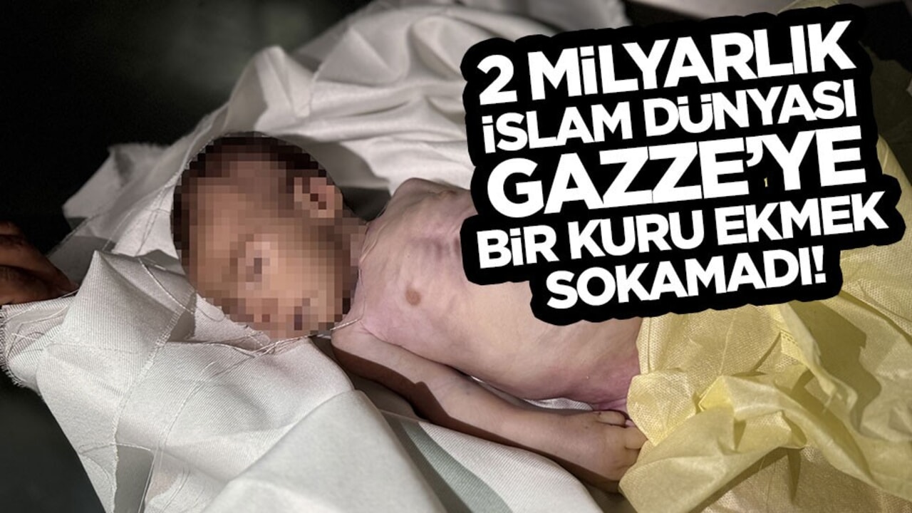 Kahpe İsrail 2 aylık Muhammed'i aç bırakarak şehit etti