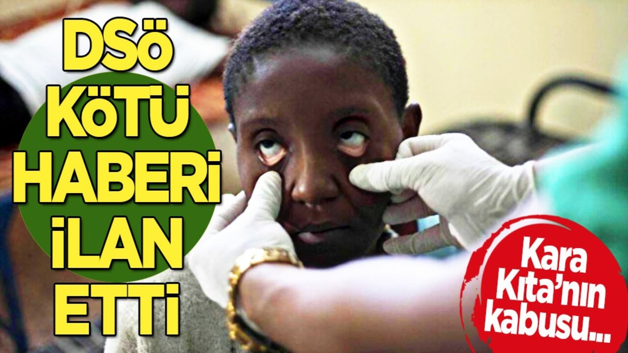 Kolera kara kıta'nın kabusu: Ölü sayısı endişelendirdi! Aşı calışmaları devam ediyor 