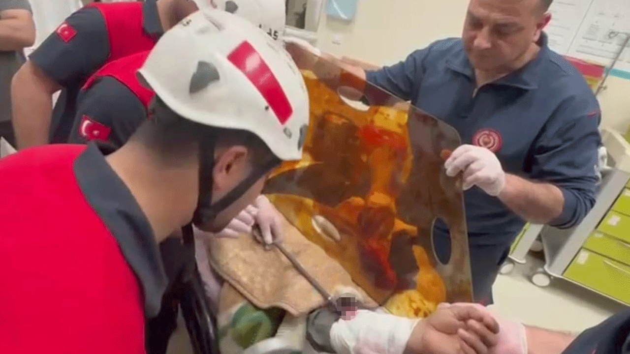 Koluna saplanan demir şişin yarısını itfaiye yarısını doktorlar çıkardı