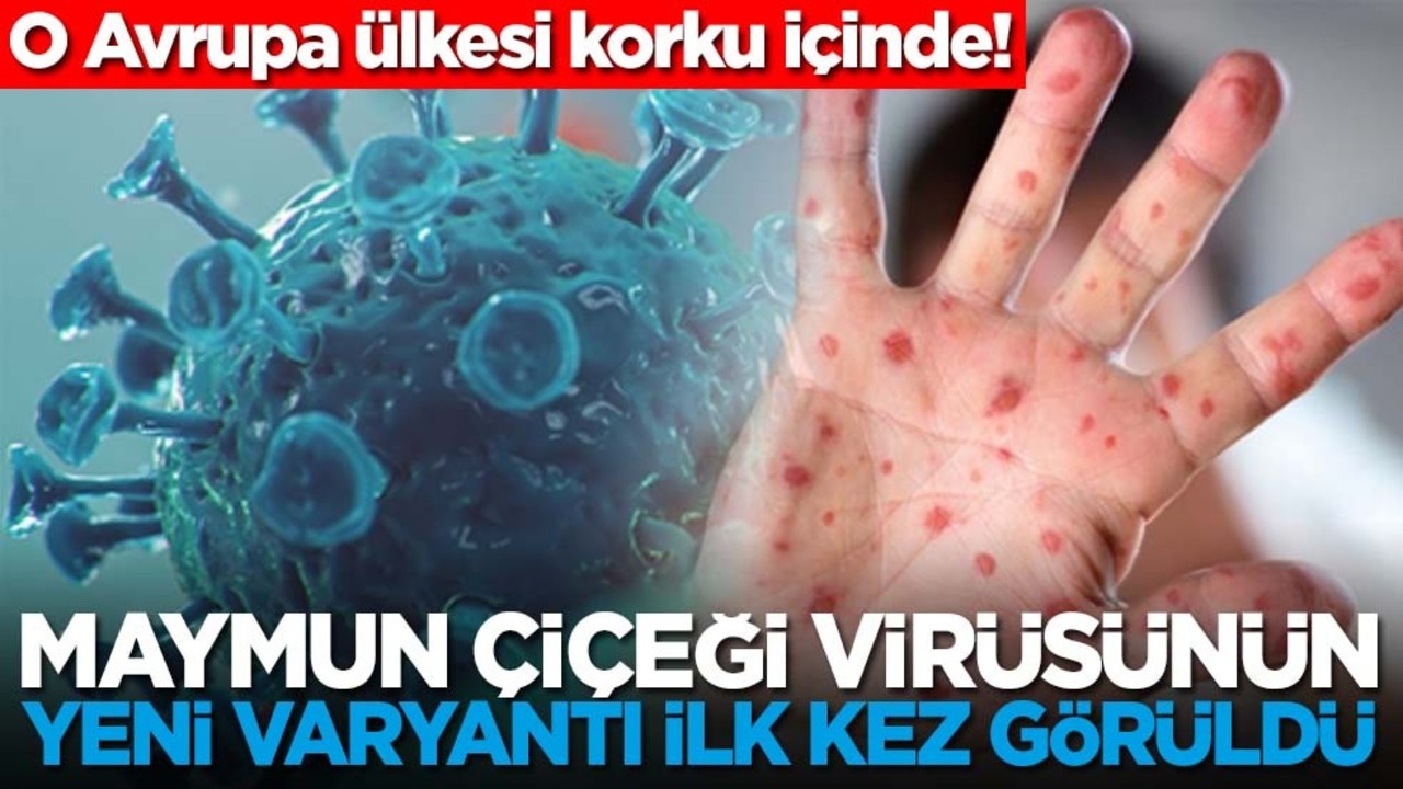 O Avrupa ülkesi korku içinde! Maymun çiçeği virüsünün yeni varyantı ilk kez görüldü