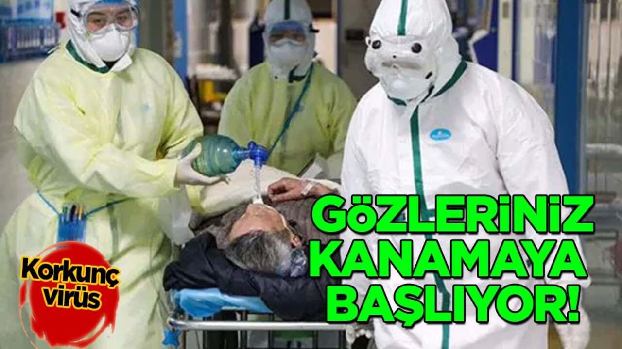 Virüsü kapan zombiye dönüyor: Yüzlerce kişiyi etkisi altına alan bilanço! Herkes perişan