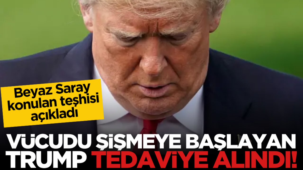 Vücudu şişmeye başlayan Trump tedaviye alındı! Beyaz Saray konulan teşhisi açıkladı