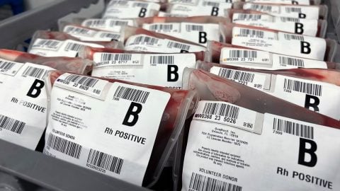 B kan grubuna sahip olanlar dikkat! Bu hastalığa yakalanma riskiniz yüzde 28 daha yüksek