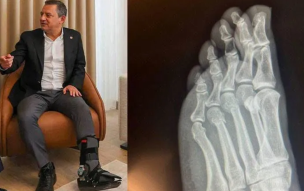 1 haftadır gizemini koruyor! Özgür’ün ayak muamması dalga konusu oldu