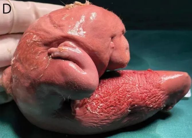 1 yaşındaki bebek, kafası geniş olduğu için hastaneye götürüldü! Gerçek bir sene sonra ortaya çıktı! Meğerse beyninin içinde... Bilim dünyası şokta
