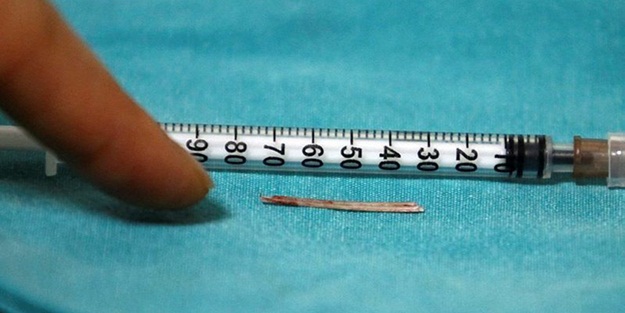 10 gün sonra gözünden çıkarıldı