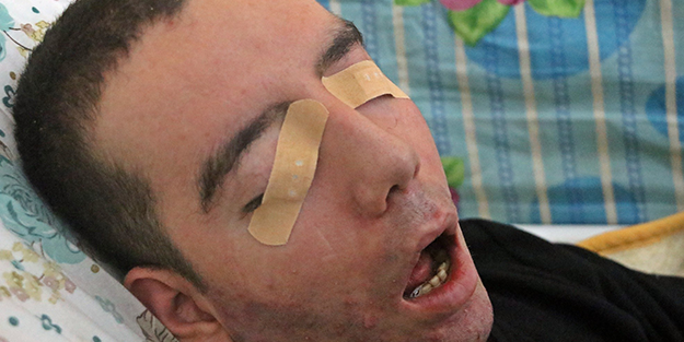 10 yıldır gözlerini bir kez bile kırpamadı! Görenlerin içi acıyor
