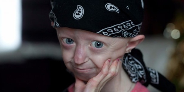 100 yaşındaki kız 17 yaşında hayatını kaybetti