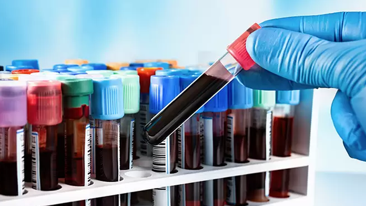 100 yaşını görenlerin kanı herkesten farklı çıktı!