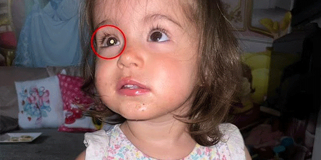 11 aylık bebeğinde kanser belirtileri fark eden anne yaşadıklarını böyle anlattı