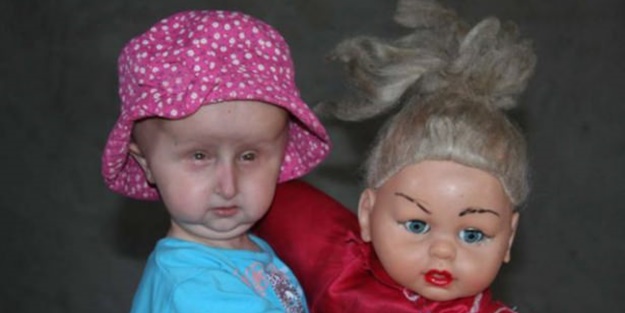 11 yaşını göremez dediler ama... - FOTO