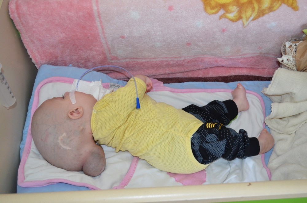 12 aylık Yunus Emre’nin yürek burkan dramı 