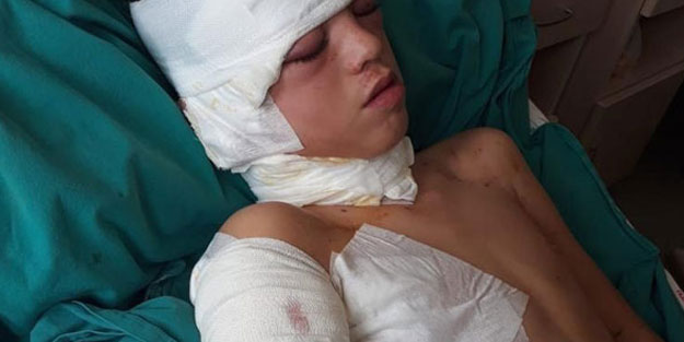 12 yaşındaki Ahmet'i köpekler parçaladı! Babası onu bulduğunda...