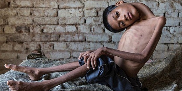 12 yıl bu halde yaşadı!