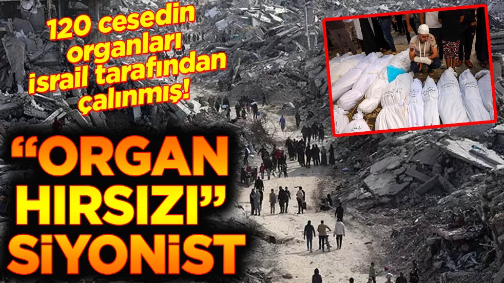 120 cesedin organları İsrail tarafından çalınmış! Organ hırsızı siyonist