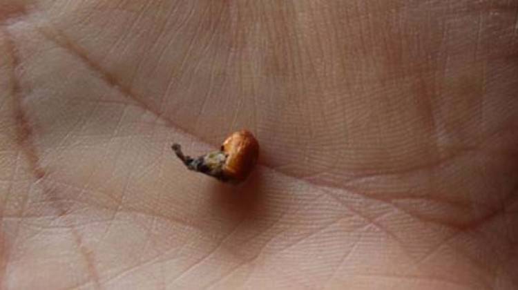 13 yaşındaki kızın kulağından çıktı