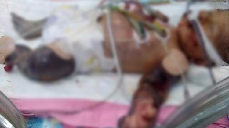 15 günlük bebeğin korkunç görüntüsü!