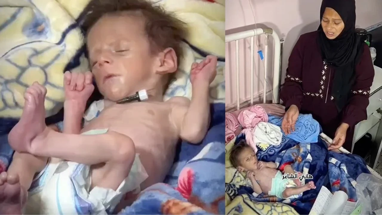 1.5 kilo Gazzeli Yusuf, açlığa yenik düştü...