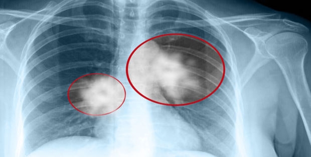 15 sigara bile kansere dönüşebilir!