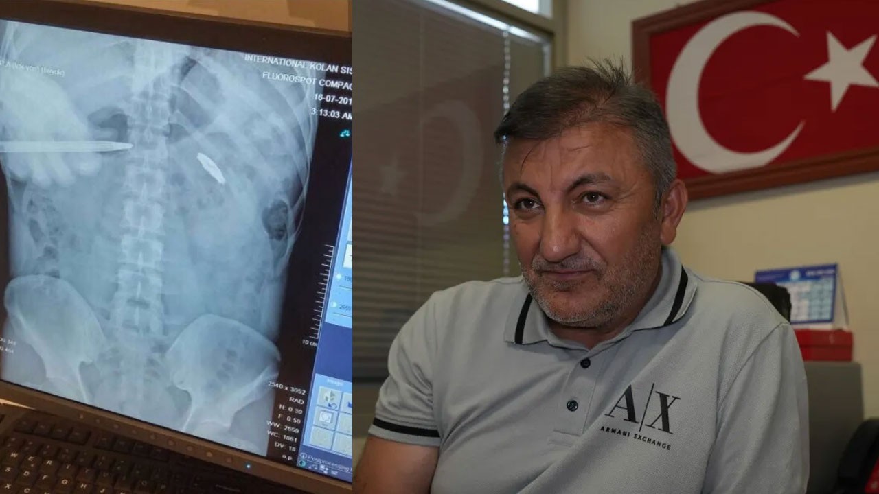 15 Temmuz gazisi 9 yıldır göğsündeki kurşunla yaşıyor