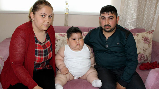 1,5 yaşında 32 kilo