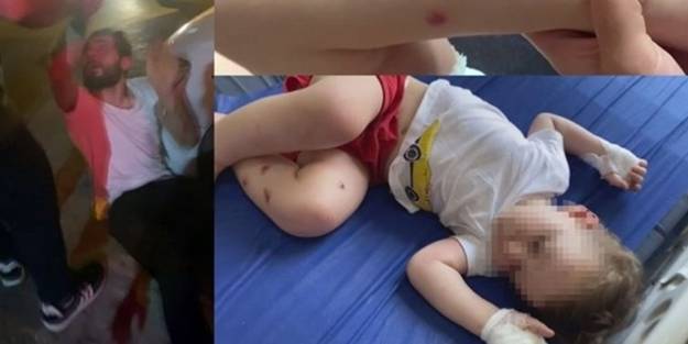 1,5 yaşındaki bebeğe işkence! Vicdansıza meydan dayağı