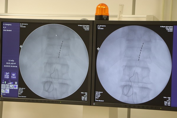 150 bin TL değerinde devlet karşılıyor! Geçmek bilmeyen ağrıya kesin çözüm