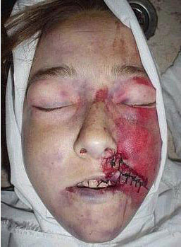 Rachel Corrie şehadetinin yıl dönümünde rahmetle anıldı