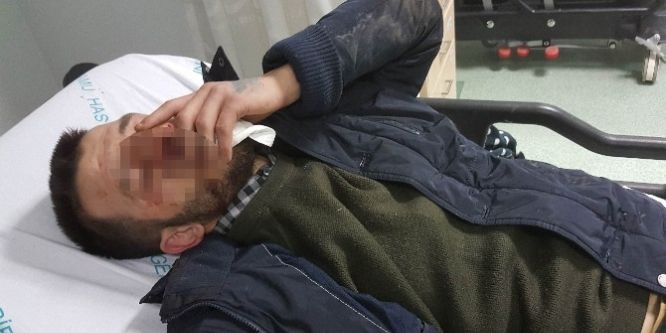 Asker eğlencesinde hastanelik oldu