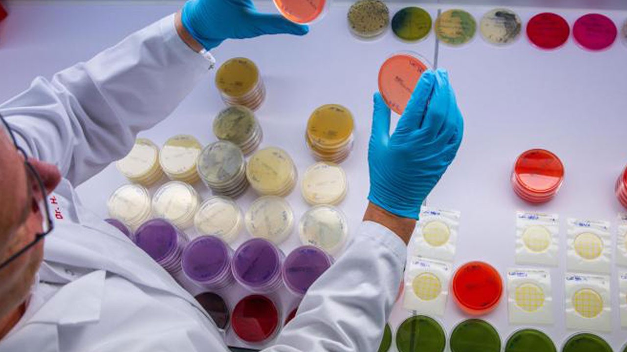 1’i çocuk 2 kişi hayatını kaybetti! O ülkede E.Coli alarmı verildi