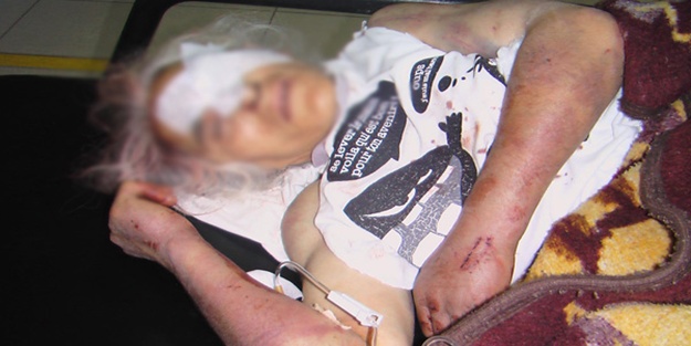 2 çocuk annesi eşini hastanelik etti!