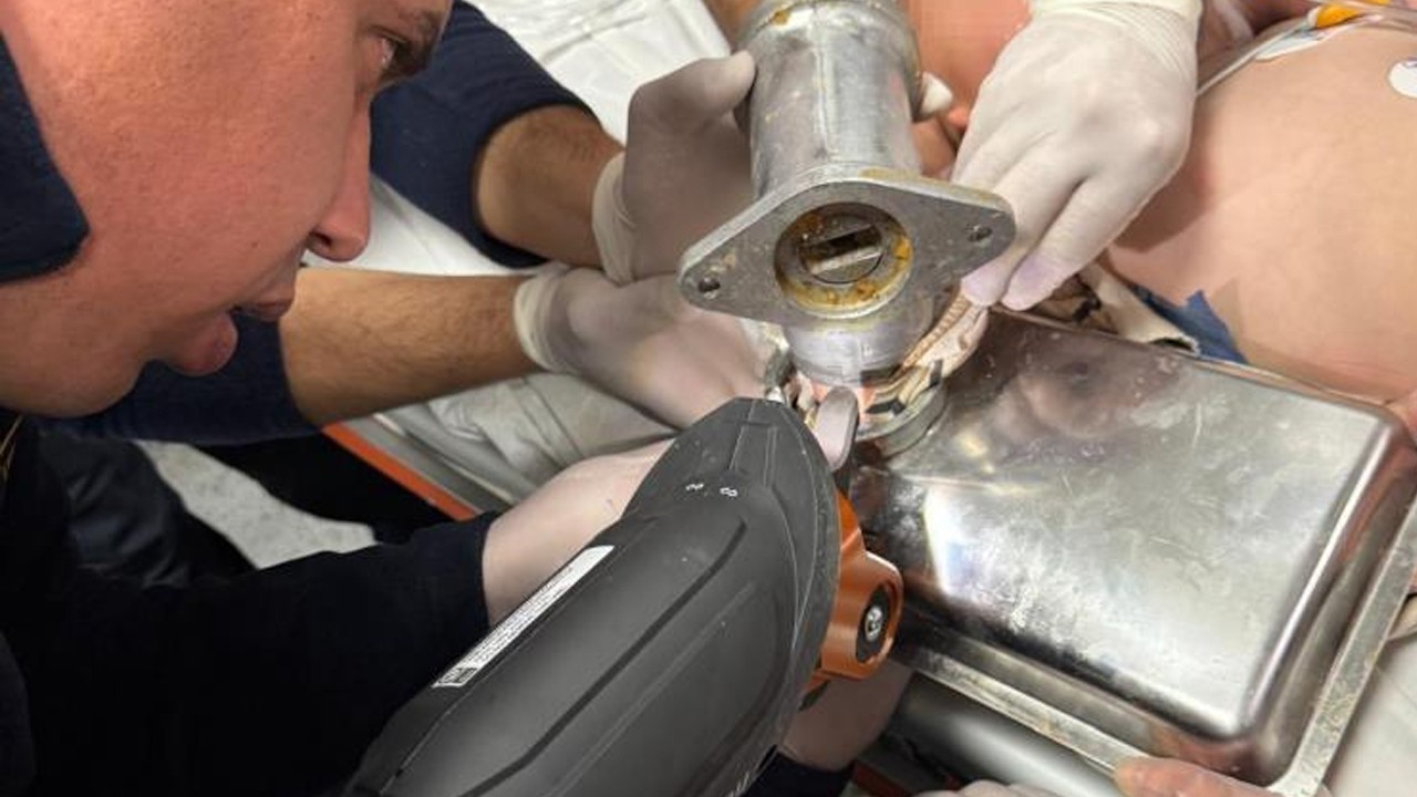 2 yaşındaki çocuk kabusu yaşadı! Kıyma makinesine elini soktu