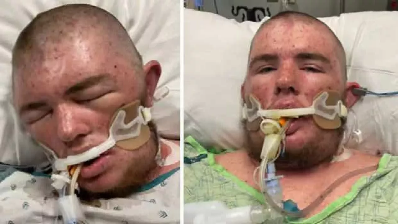 20 bin arı soktu! Bakın şimdi ne durumda