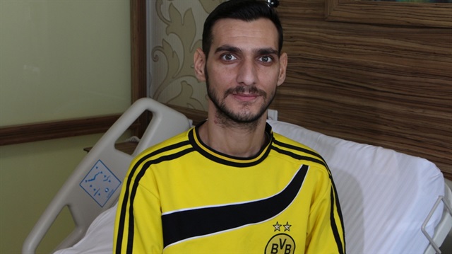 20 günde 3 kere tüm kanı değiştirildi