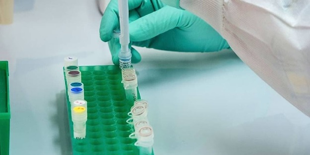 20 milyonluk ülkede koronavirüs vaka sayısı 80 bine yaklaştı