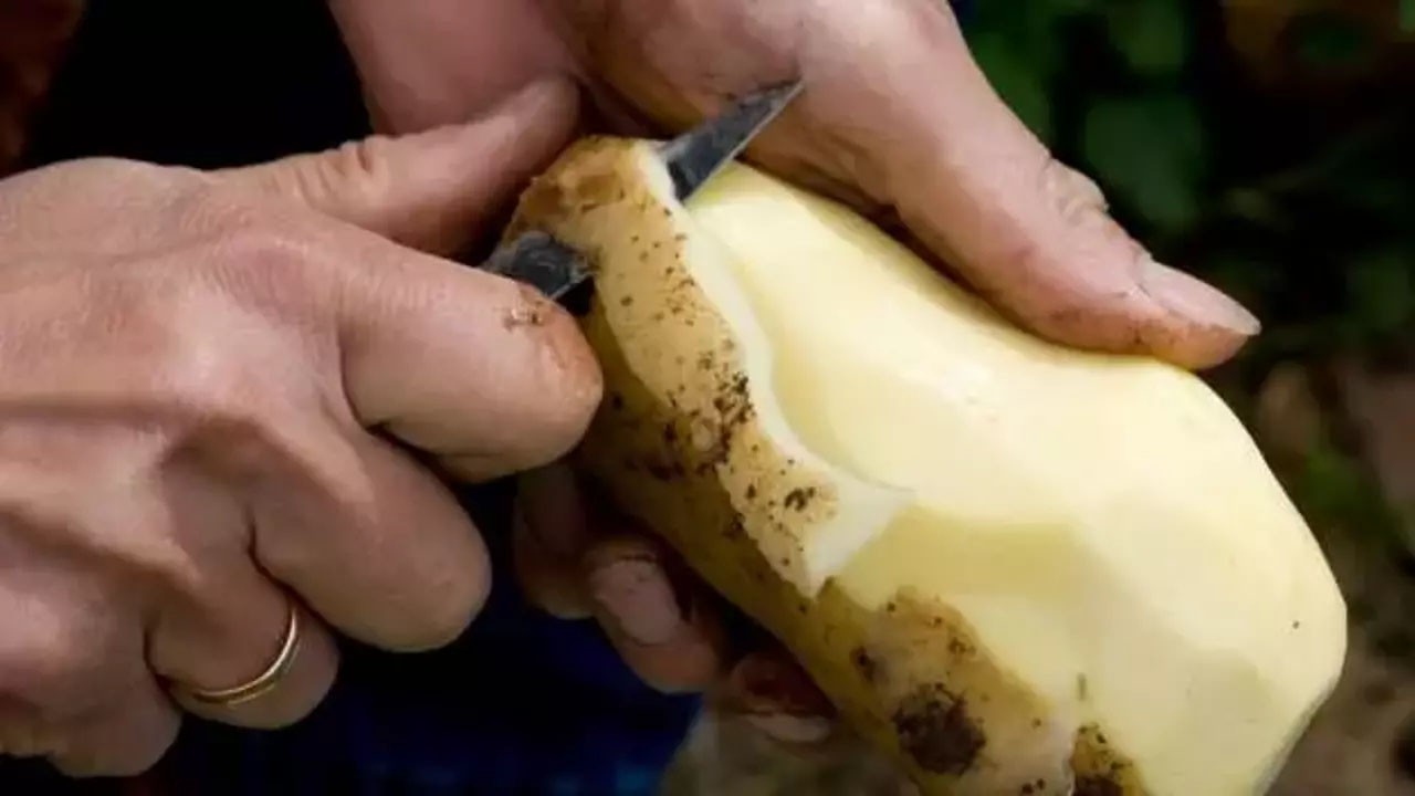 20 yıldır sadece patates yiyip yaşadıklarını anlattı! Daha henüz 29 yaşında