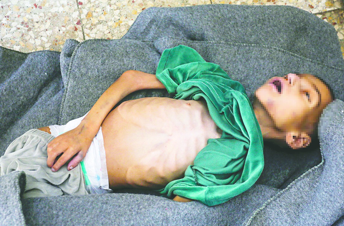 200 bin çocuk tehlikede! Gazzeli Hijazi de açlıktan öldü