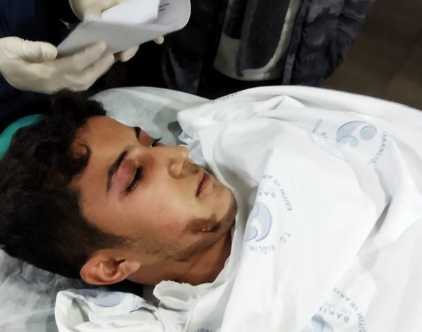 21 yaşındaki genç ikinci kez hayata tutundu!