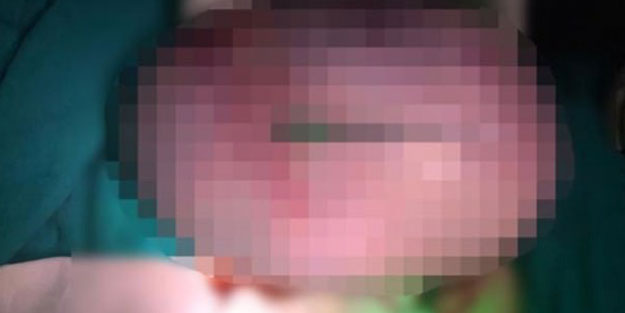 22 yaşındaki genç kadının içinden çıkana doktorlar bile inanamadı