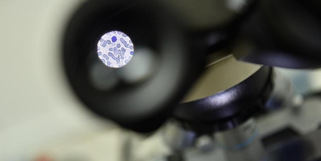 24 Maymunda denendi... o virüsü yendiler...