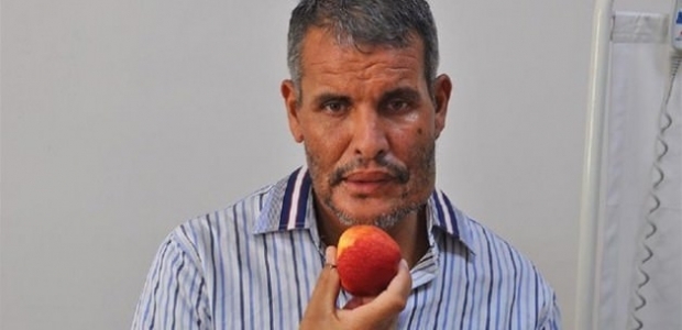 25 sene çenesiz yaşadı