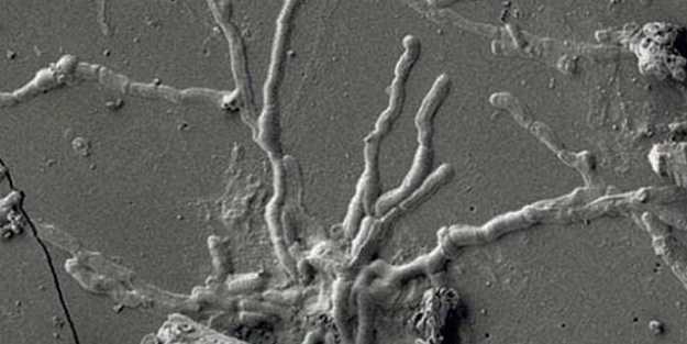 25 yaşındaki erkekte keşfedildi! 2 bin yıl önceye ait beyin bulundu