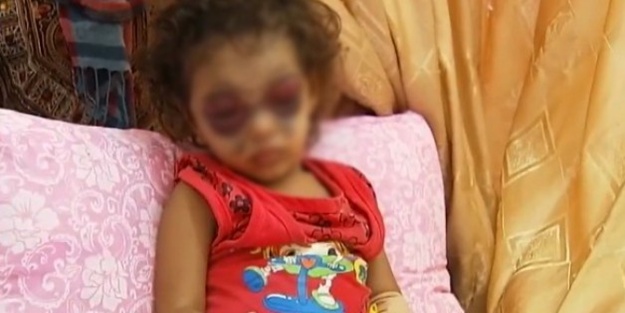  2,5 yaşındaki kızı bu hale getirdiler