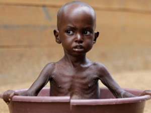 Somali’de son 2 yılda her 10 çocuktan biri açlıktan öldü