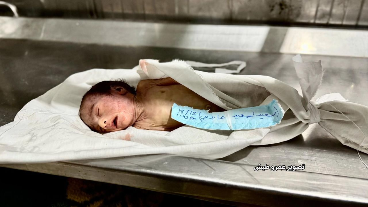 29 günlük bir bebek soğuktan can verdi!