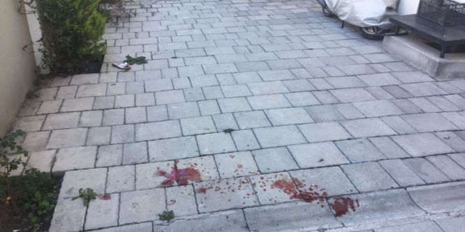 Minik kız yaşam mücadelesi veriyor